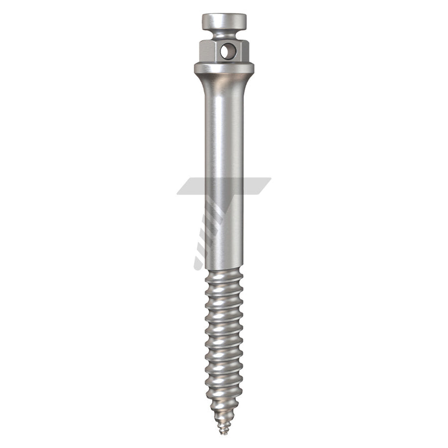 Orthodontic Zygomatic Micro-Implant (TADs)